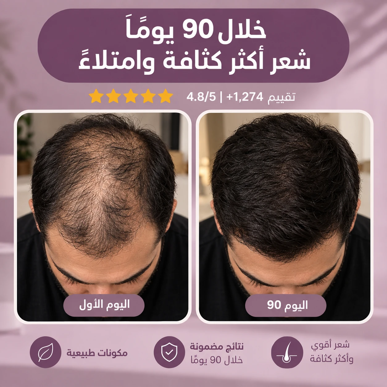 نتائج MOOD للرجال خلال 90 يوماً — قبل وبعد
